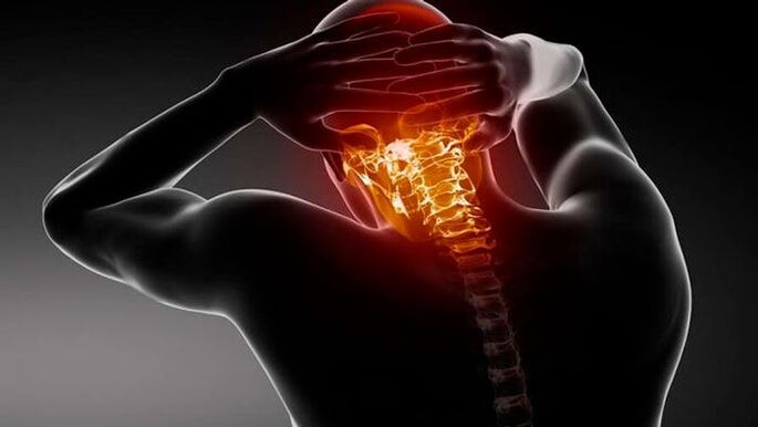 hoofdpijn met cervicale osteochondrose