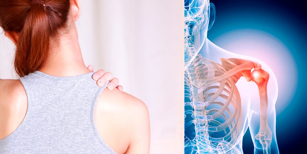 De ontwikkeling van artrose van de schouder leidt geleidelijk tot constante pijn