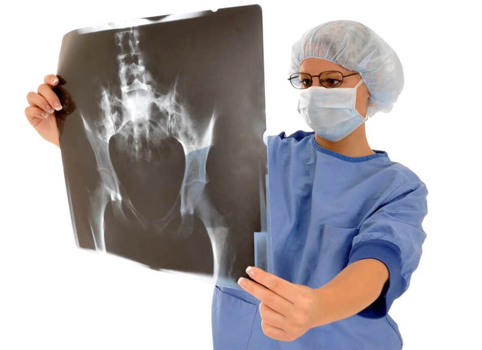 Röntgenfoto's van het heupgewricht zullen de arts helpen de oorzaak van de pijn te bepalen