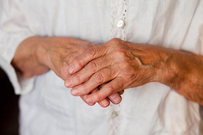 Pijn in de gewrichten van de handen stoort vaak oudere mensen