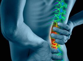 Oorzaken en symptomen van osteochondrose