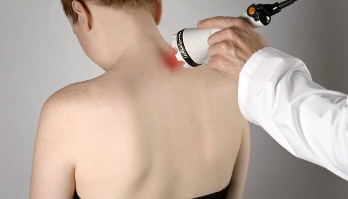 lasertherapie voor cervicale osteochondrose