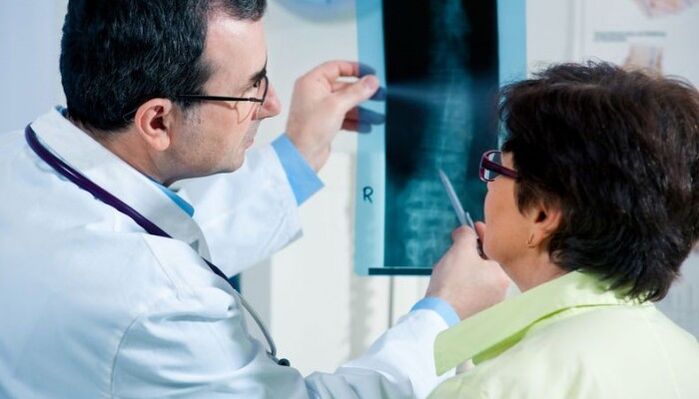 radiografie als methode voor het diagnosticeren van cervicale osteochondrose